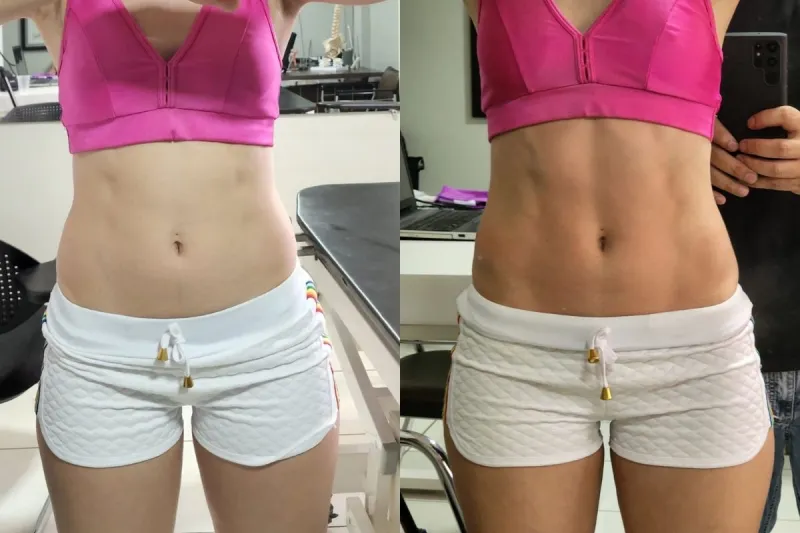 Harmonização Corporal